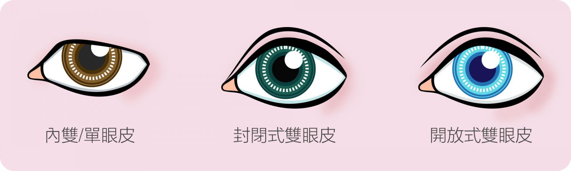 眼皮常見種類