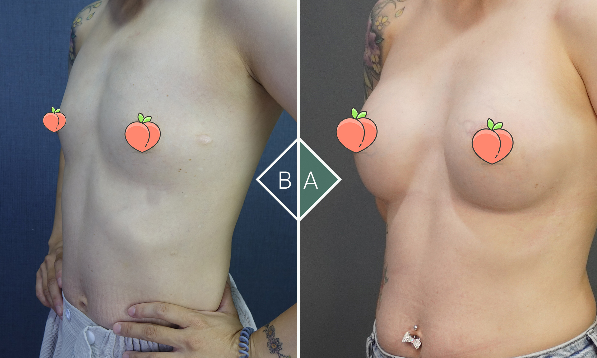 魅力加倍,自信翻新:解密魔滴隆乳的驚人效果