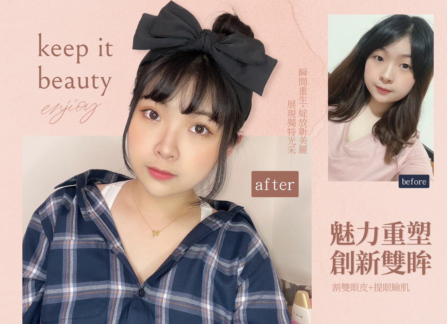 閃耀雙眼：探索割雙眼皮的獨特魅力