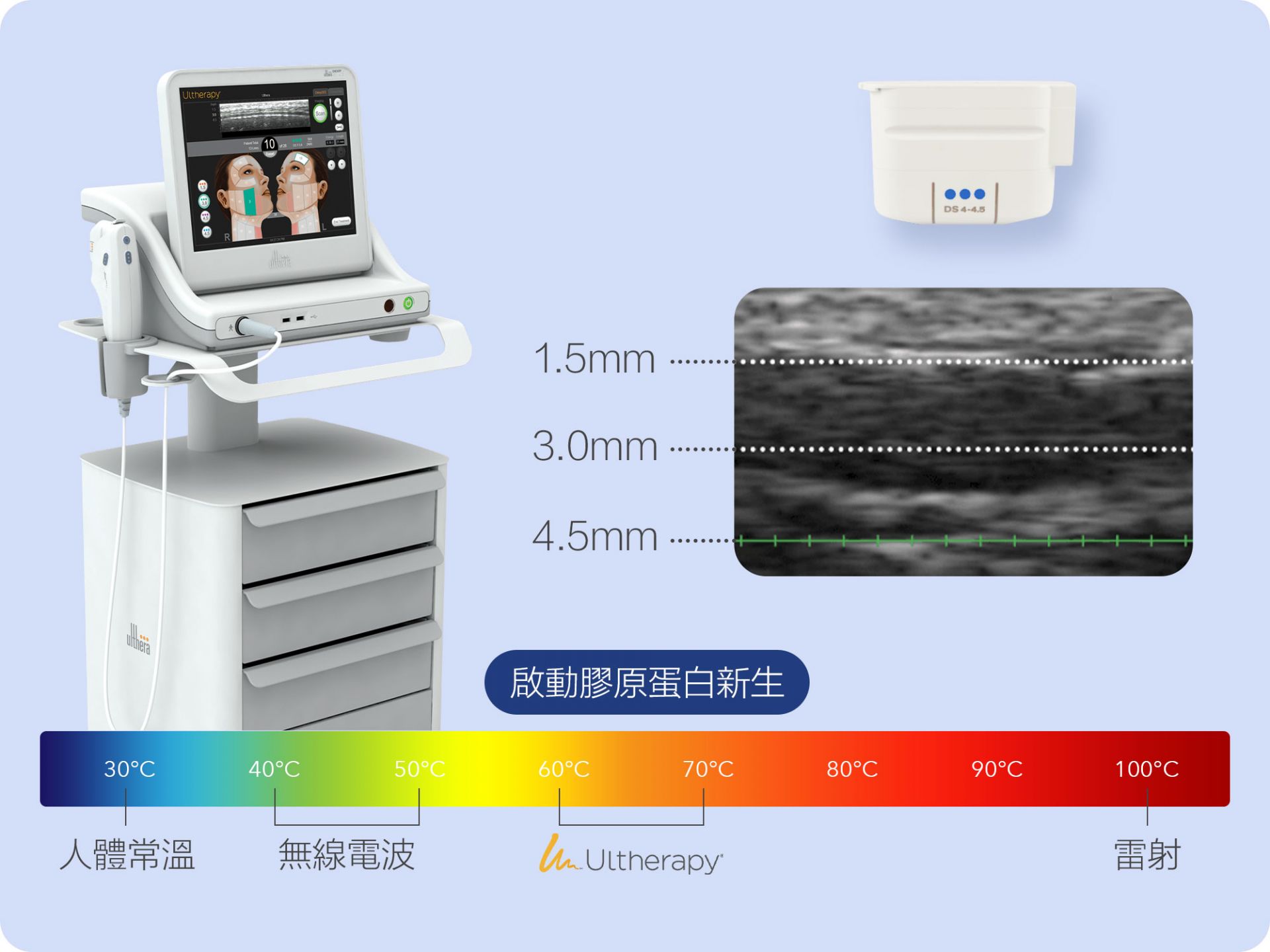 美國音波 2.0 示意圖