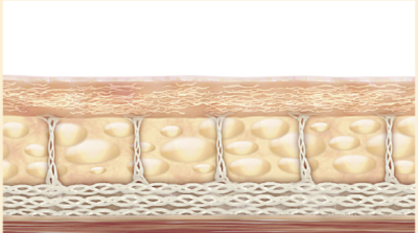 新生膠原蛋白生成、緊緻拉提升效示意圖
