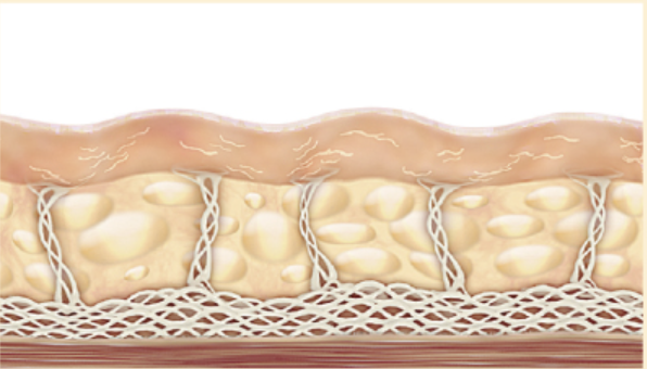 膠原蛋白流失示意圖